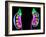 Human Kidneys, Artwork-Roger Harris-Framed Photographic Print