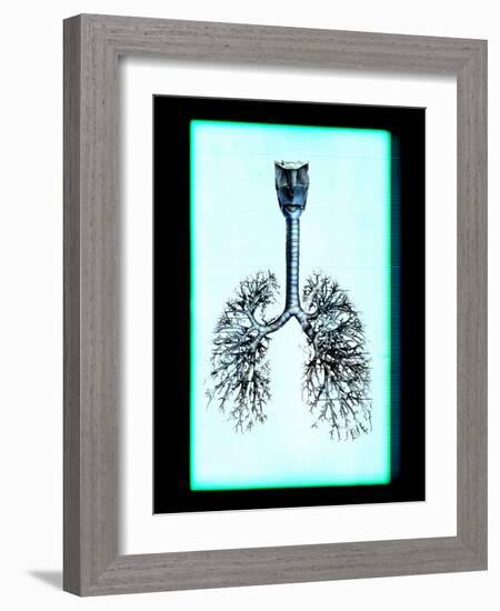 Human Lungs-Neal Grundy-Framed Photographic Print