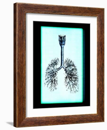 Human Lungs-Neal Grundy-Framed Photographic Print