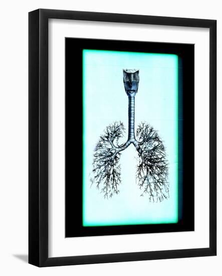Human Lungs-Neal Grundy-Framed Photographic Print