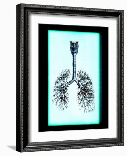 Human Lungs-Neal Grundy-Framed Photographic Print