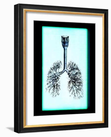 Human Lungs-Neal Grundy-Framed Photographic Print