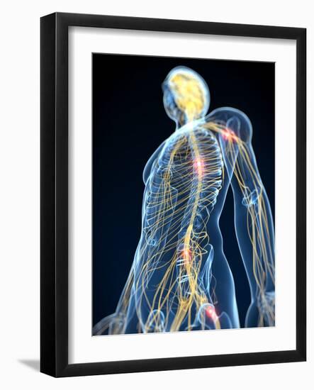 Human Nervous System, Artwork-SCIEPRO-Framed Photographic Print