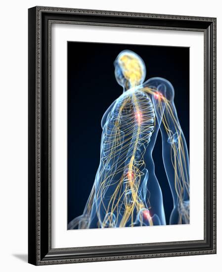 Human Nervous System, Artwork-SCIEPRO-Framed Photographic Print