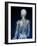 Human Nervous System, Artwork-SCIEPRO-Framed Photographic Print