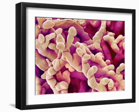 Human Placenta, SEM-Susumu Nishinaga-Framed Photographic Print