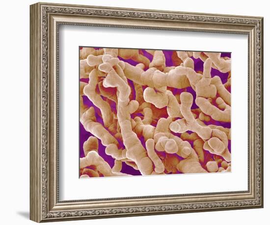 Human Placenta-Micro Discovery-Framed Photographic Print