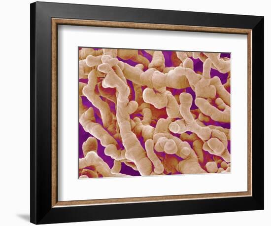 Human Placenta-Micro Discovery-Framed Photographic Print