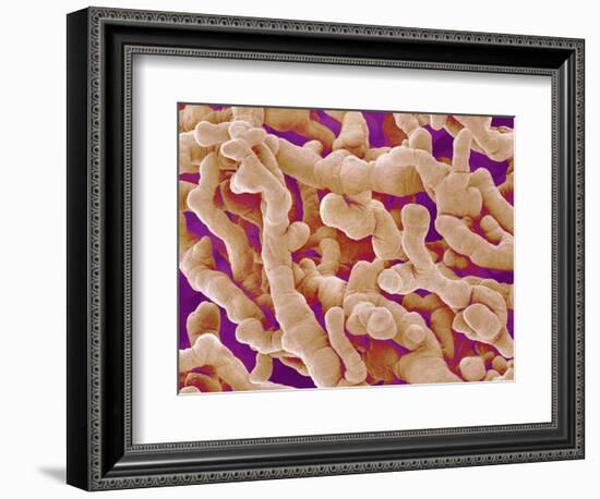 Human Placenta-Micro Discovery-Framed Photographic Print