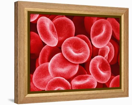 Human Red Blood Cells-Micro Discovery-Framed Premier Image Canvas