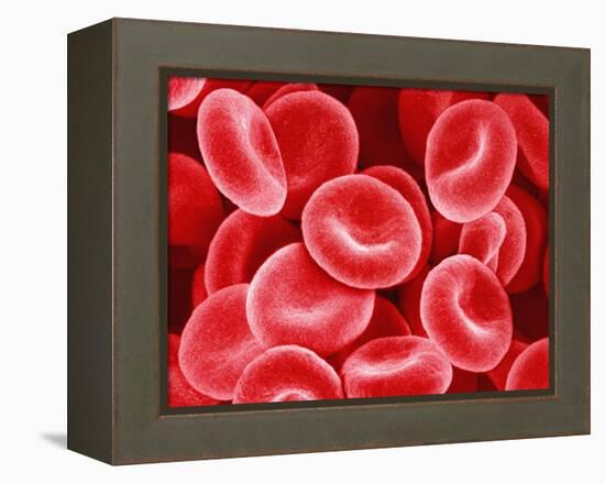 Human Red Blood Cells-Micro Discovery-Framed Premier Image Canvas