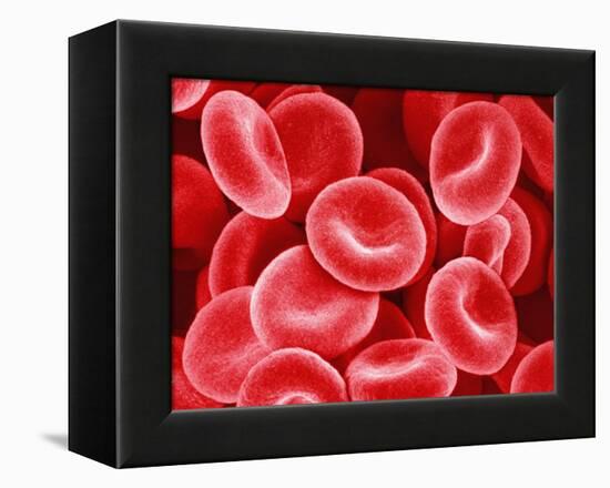 Human Red Blood Cells-Micro Discovery-Framed Premier Image Canvas