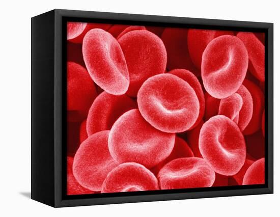 Human Red Blood Cells-Micro Discovery-Framed Premier Image Canvas