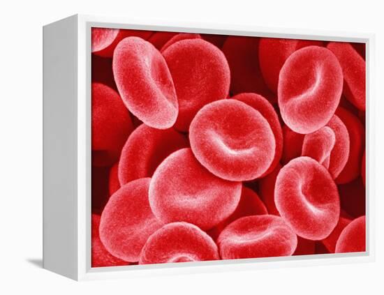 Human Red Blood Cells-Micro Discovery-Framed Premier Image Canvas