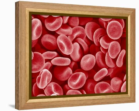 Human Red blood cells-Micro Discovery-Framed Premier Image Canvas