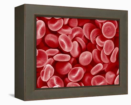 Human Red blood cells-Micro Discovery-Framed Premier Image Canvas