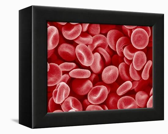 Human Red blood cells-Micro Discovery-Framed Premier Image Canvas