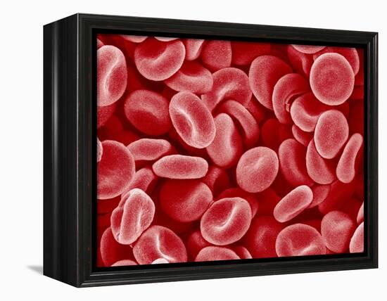 Human Red blood cells-Micro Discovery-Framed Premier Image Canvas