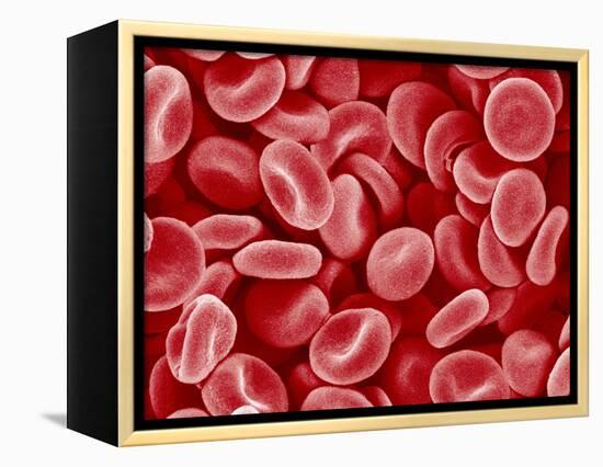 Human Red blood cells-Micro Discovery-Framed Premier Image Canvas