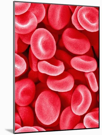 Human Red Blood Cells-Micro Discovery-Mounted Photographic Print