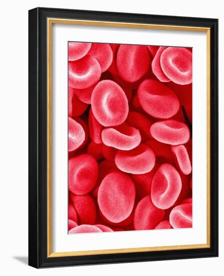 Human Red Blood Cells-Micro Discovery-Framed Photographic Print