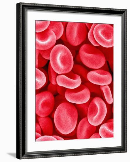 Human Red Blood Cells-Micro Discovery-Framed Photographic Print