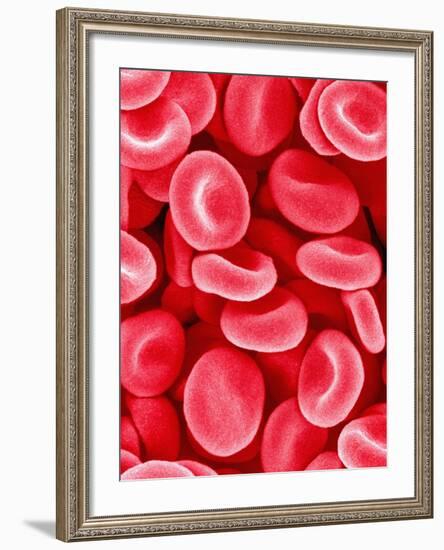 Human Red Blood Cells-Micro Discovery-Framed Photographic Print