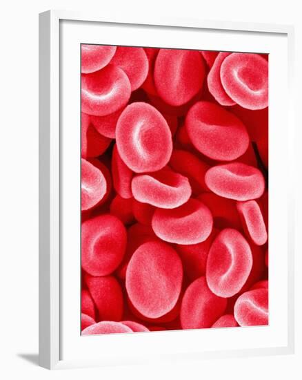 Human Red Blood Cells-Micro Discovery-Framed Photographic Print