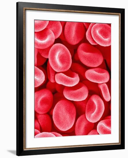 Human Red Blood Cells-Micro Discovery-Framed Photographic Print