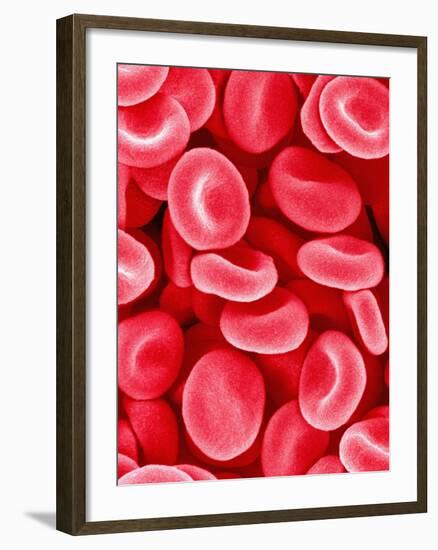 Human Red Blood Cells-Micro Discovery-Framed Photographic Print