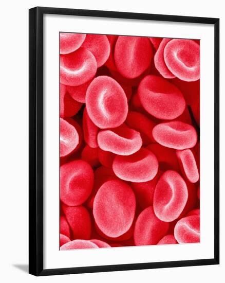 Human Red Blood Cells-Micro Discovery-Framed Photographic Print