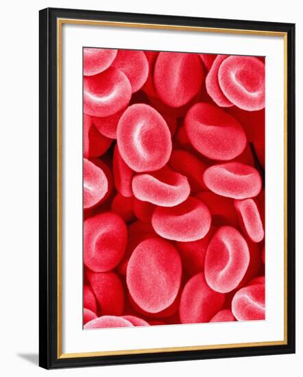 Human Red Blood Cells-Micro Discovery-Framed Photographic Print