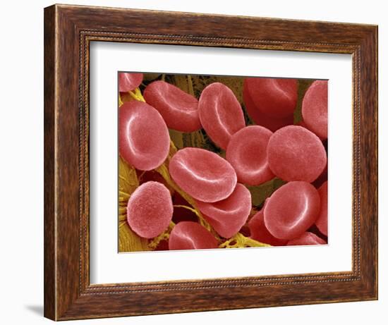 Human Red Blood Cells-Micro Discovery-Framed Photographic Print