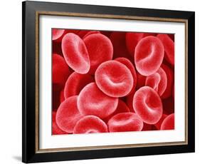 Human Red Blood Cells-Micro Discovery-Framed Photographic Print