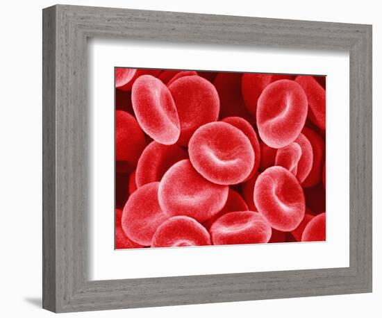 Human Red Blood Cells-Micro Discovery-Framed Photographic Print