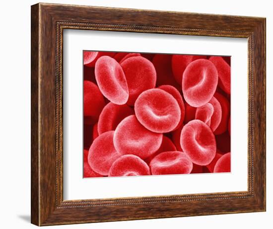 Human Red Blood Cells-Micro Discovery-Framed Photographic Print