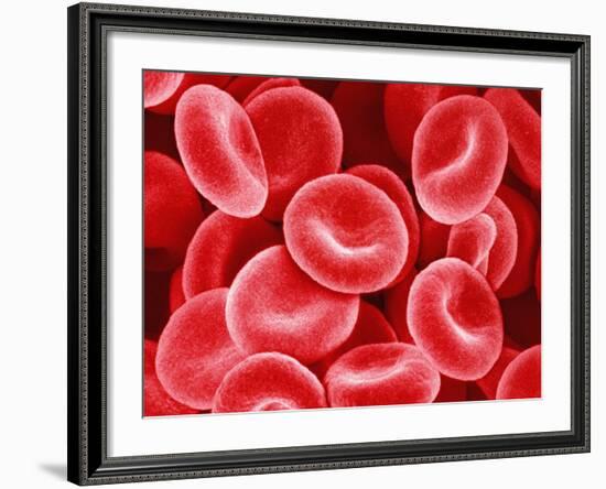 Human Red Blood Cells-Micro Discovery-Framed Photographic Print