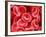 Human Red Blood Cells-Micro Discovery-Framed Photographic Print