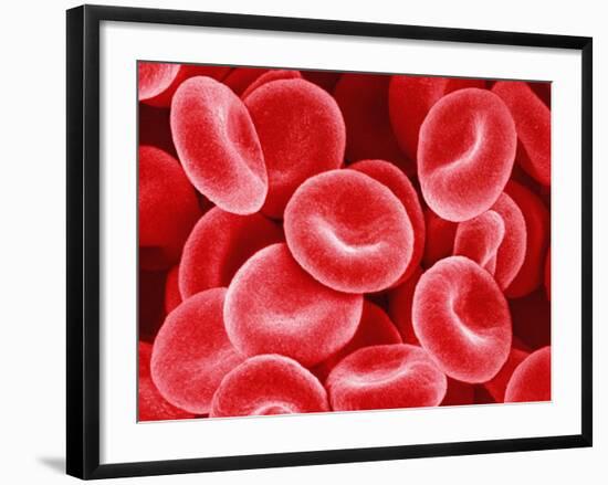 Human Red Blood Cells-Micro Discovery-Framed Photographic Print