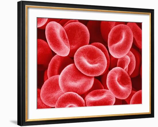 Human Red Blood Cells-Micro Discovery-Framed Photographic Print