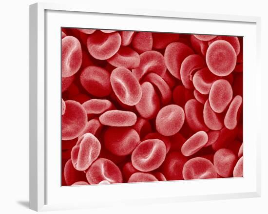 Human Red blood cells-Micro Discovery-Framed Photographic Print