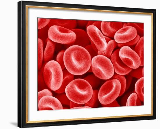 Human Red blood cells-Micro Discovery-Framed Photographic Print