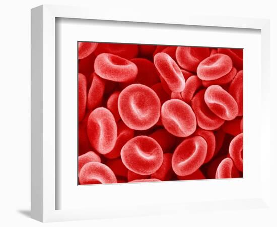 Human Red blood cells-Micro Discovery-Framed Photographic Print