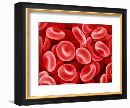 Human Red blood cells-Micro Discovery-Framed Photographic Print