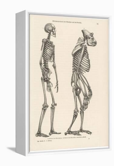 Human Skeleton Compared with That of a Gorilla-null-Framed Premier Image Canvas