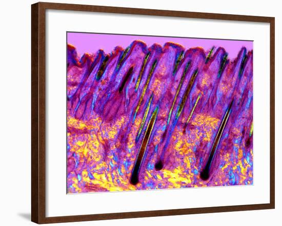 Human Skin, Polarised Light Micrograph-Dr. Keith Wheeler-Framed Photographic Print