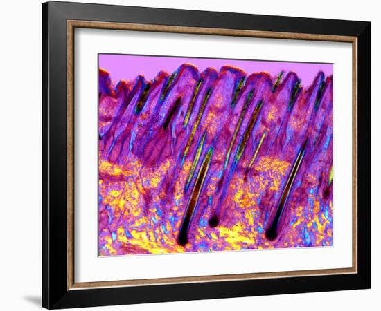 Human Skin, Polarised Light Micrograph-Dr. Keith Wheeler-Framed Photographic Print