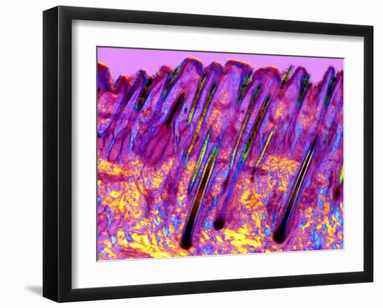 Human Skin, Polarised Light Micrograph-Dr. Keith Wheeler-Framed Photographic Print