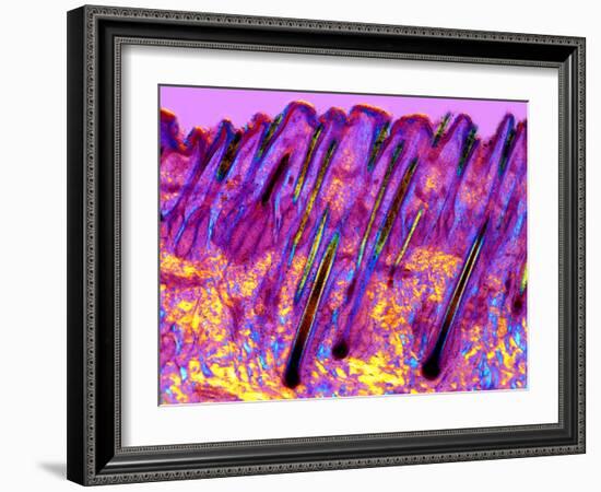 Human Skin, Polarised Light Micrograph-Dr. Keith Wheeler-Framed Photographic Print