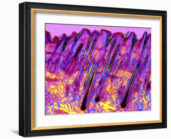 Human Skin, Polarised Light Micrograph-Dr. Keith Wheeler-Framed Photographic Print